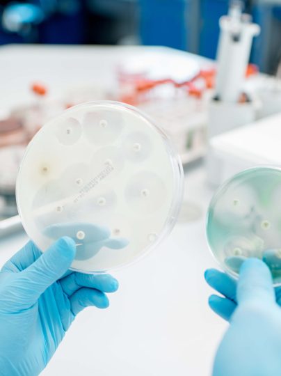 Looking on the effect of antibiotics on bacteria in Petri dishes at the laboratory